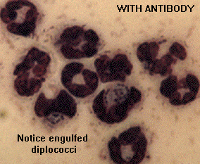Antibody Photo