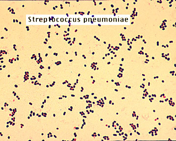 What are viridans streptococci?