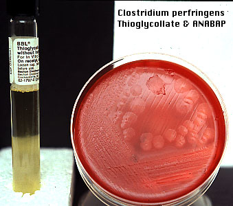 Clostridium Botulinum Morphology