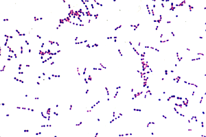 microbiology lab reports