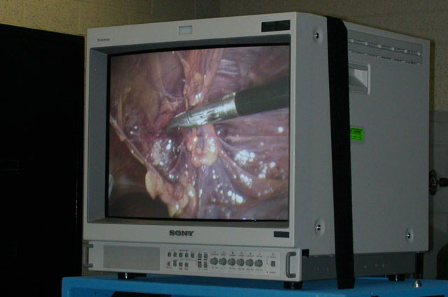 Senior Surgical Elective - Laparoscopic procedure with cadaveric specimens