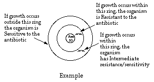 Kirby Bauer Chart