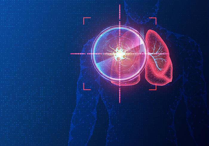 Digital illustration of human lungs with a target symbol highlighting a tumor in the left lung, representing lung cancer detection or treatment.