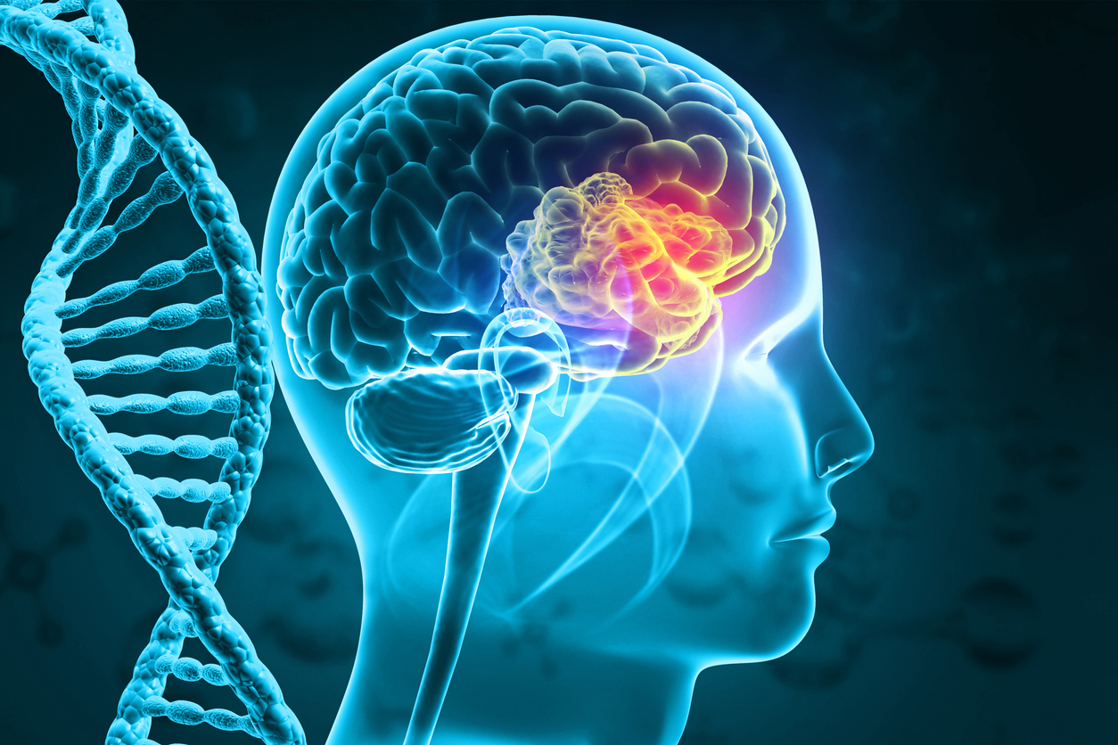 Brain tumor