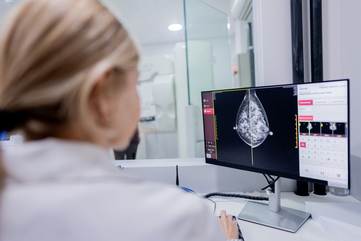 mammography image