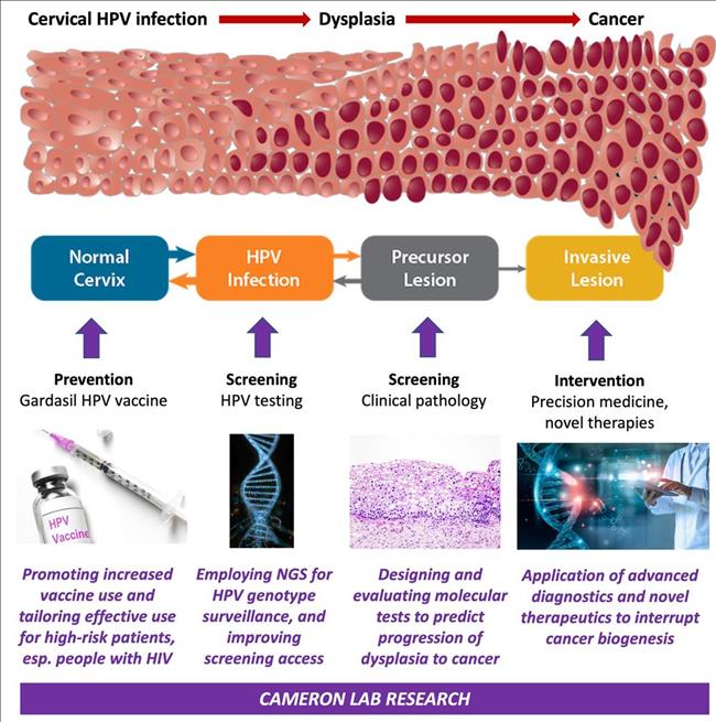 Infographic illustrating the progression of cervical HPV infection to dysplasia and cancer, highlighting prevention through vaccination, screening with HPV testing and pathology, and intervention with precision medicine and novel therapies.