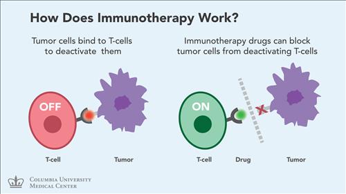 immunotherapy