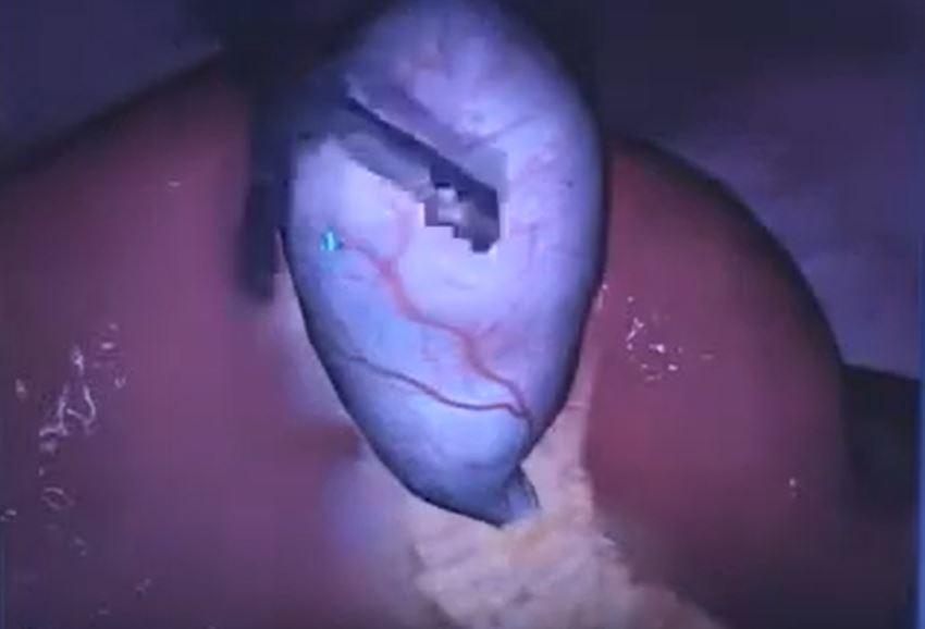 Laproscopic Surgery Simulator