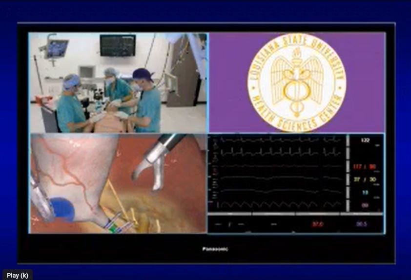 Surgical Simulation Quad Screen