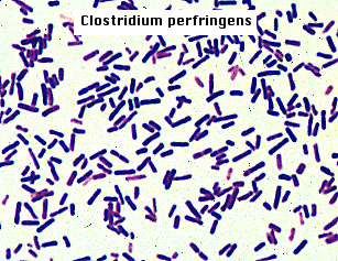 corynebacterium xerosis morphology