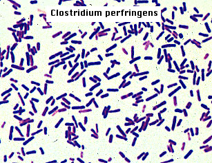 corynebacterium xerosis colony morphology