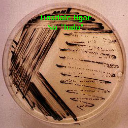 corynebacterium xerosis colony morphology