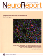 neuro report 2005