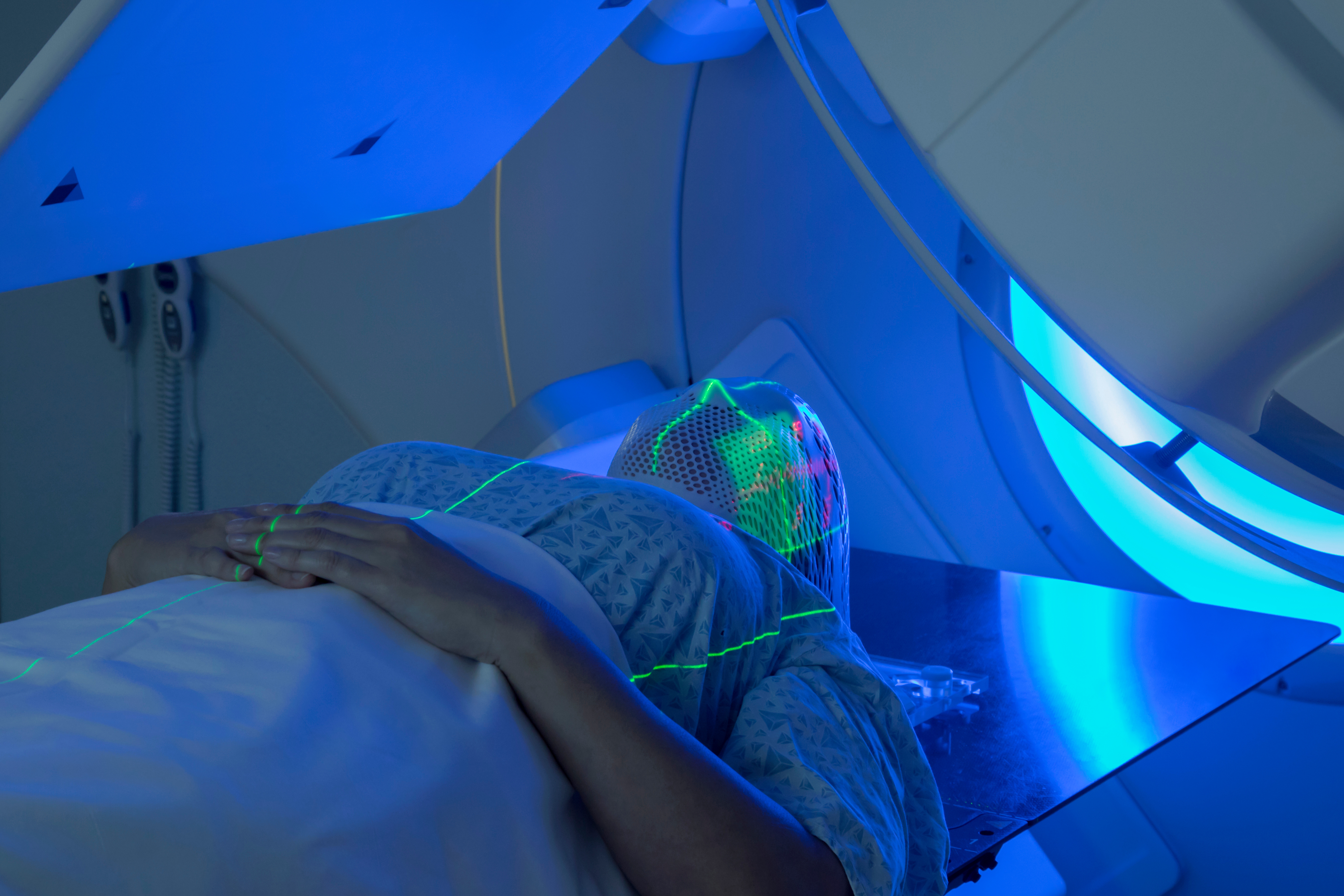 Patient lying on a treatment table inside a radiation therapy machine, wearing a mesh stabilization mask over the head. Green laser alignment lines are projected across the patient and mask, while blue illumination from the medical equipment surrounds the treatment area in a clinical healthcare setting.