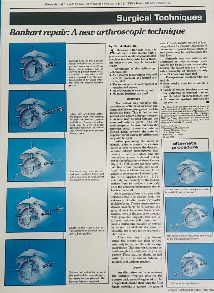 Dr. Neil Makis Bankart Suture Repair Published in AAOS April 1990 P1