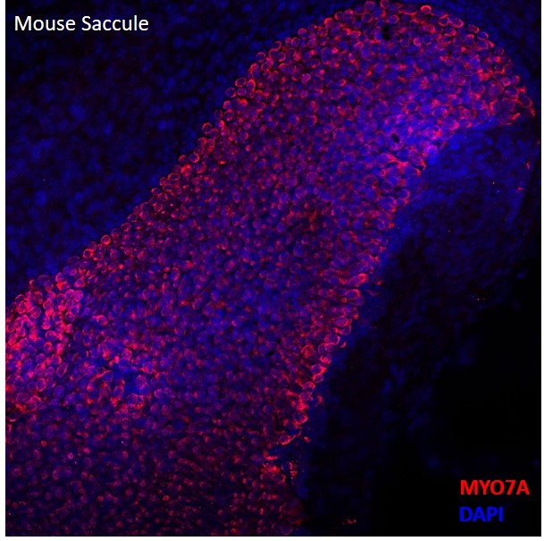 mouse-saccule