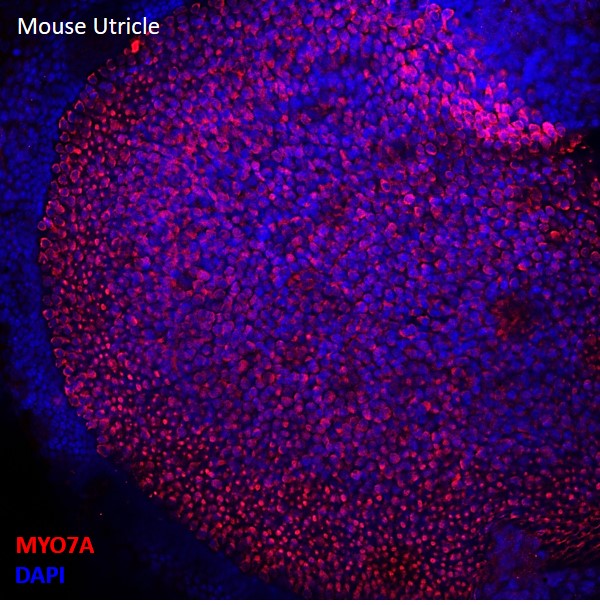 utricle