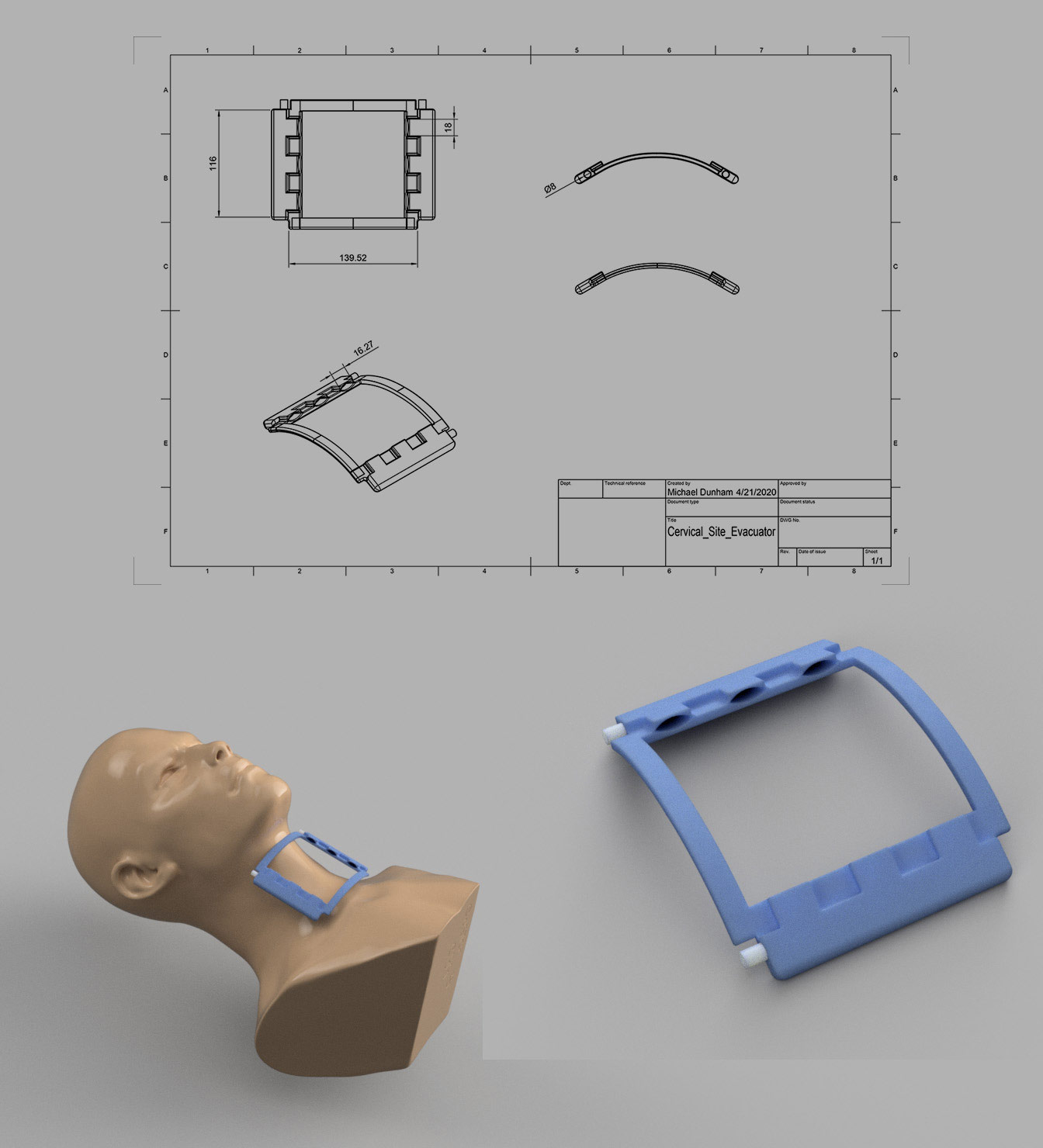 Tracheostomy Site Evacuator