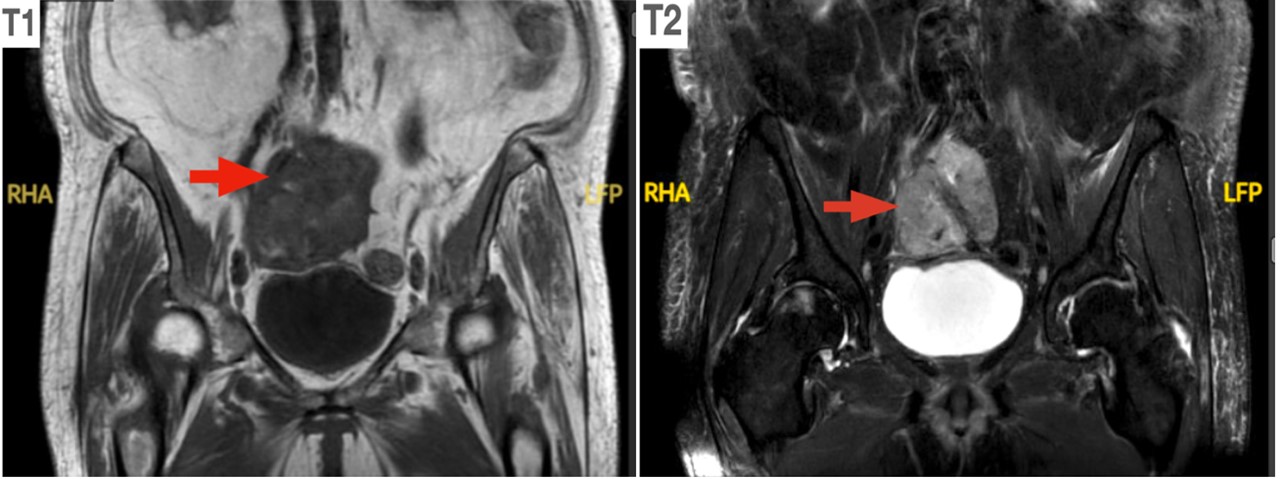 RadiologyImages