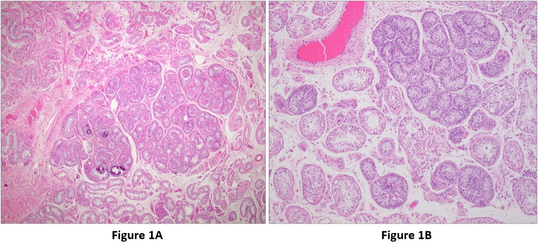 Figure 1A and 1B