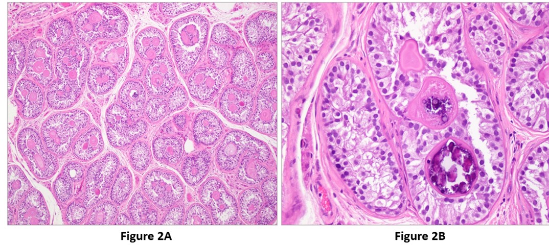 Figure 2A and 2B