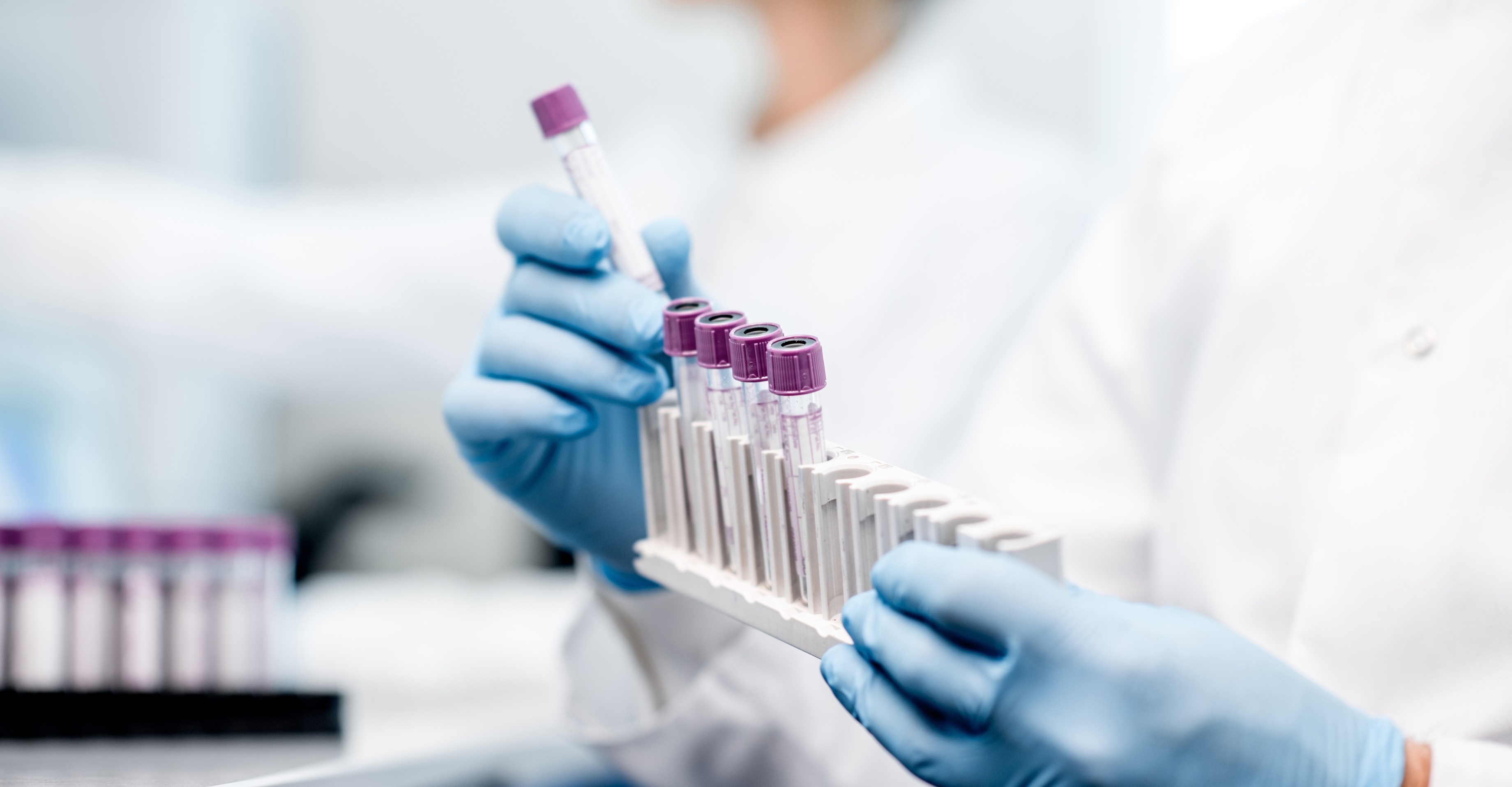 test tubes