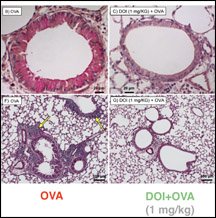 nichols_lung