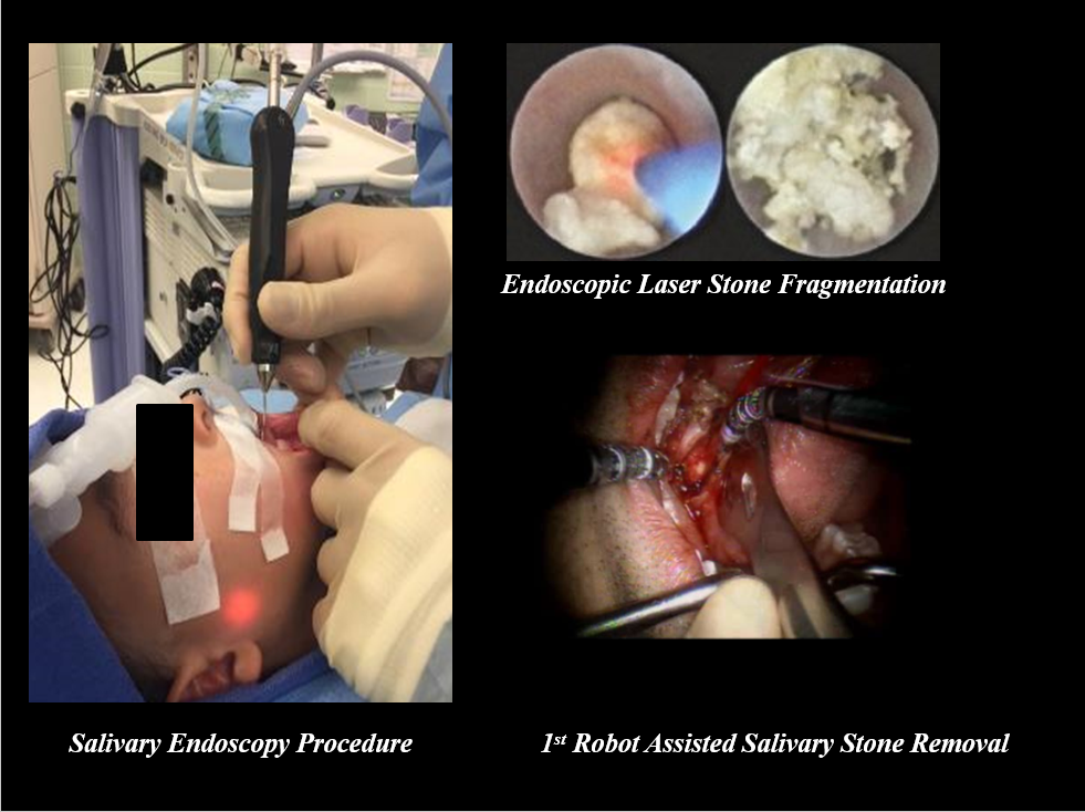 Photo_Dean Seminar Series_March 21_Endoscopic Stone Fragmentation