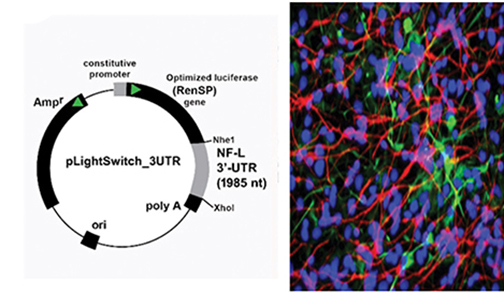 Image of Alzheimer's Research