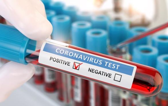 Coronavirus Test Positive